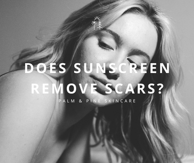 Does Sunscreen Help To Remove Scars?